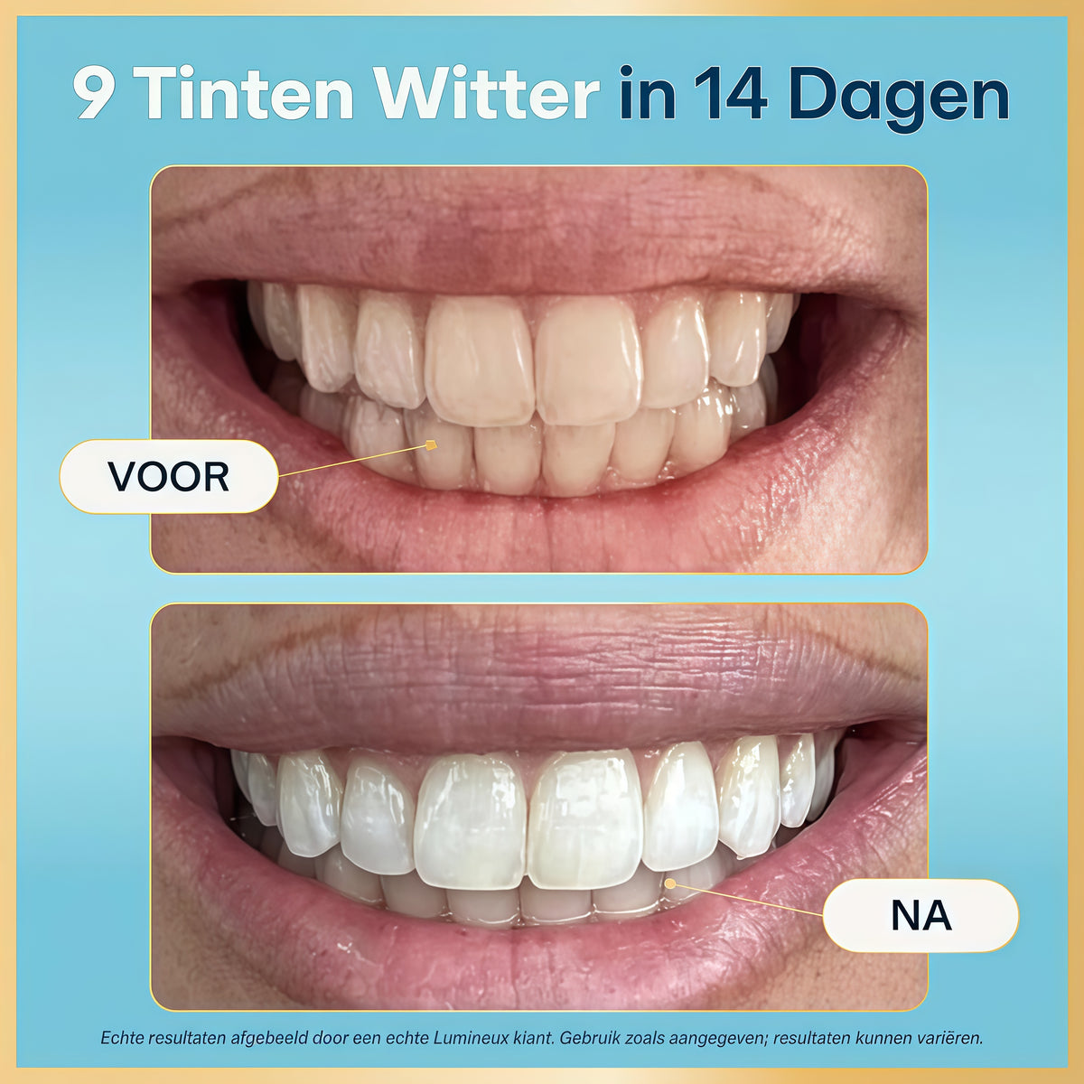Lumineux Teeth Whitening Strips, Peroxide Free, 21 Treatments (3 Months)