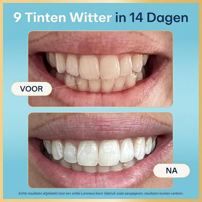 Lumineux Teeth Whitening Strips, Peroxide Free, 21 Treatments (3 Months)
